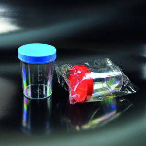 Contenedores de orina de 200 ml